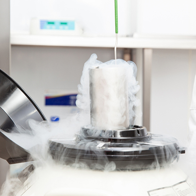 Sperm freezing in Guntur